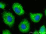 SUMF2 Antibody in Immunocytochemistry (ICC/IF)