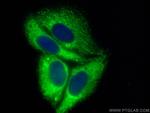 EIF2A/CDA02 Antibody in Immunocytochemistry (ICC/IF)