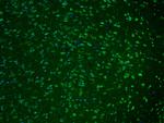 Cathepsin K Antibody in Immunohistochemistry (Paraffin) (IHC (P))