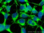 ATG3 Antibody in Immunocytochemistry (ICC/IF)