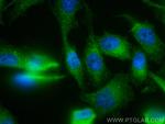 ATG12 Antibody in Immunocytochemistry (ICC/IF)