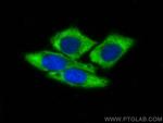 Ribosomal protein L4 Antibody in Immunocytochemistry (ICC/IF)