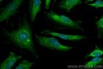 ECHS1 Antibody in Immunocytochemistry (ICC/IF)