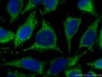 ECHS1 Antibody in Immunocytochemistry (ICC/IF)