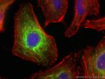 Keratin 81 Antibody in Immunocytochemistry (ICC/IF)
