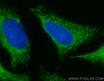 FH Antibody in Immunocytochemistry (ICC/IF)