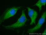 NDOR1/NR1 Antibody in Immunocytochemistry (ICC/IF)