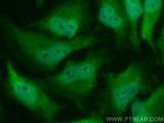 HNRNPK Antibody in Immunocytochemistry (ICC/IF)