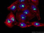 UTP14A Antibody in Immunocytochemistry (ICC/IF)