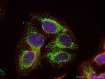 TIMM9 Antibody in Immunocytochemistry (ICC/IF)