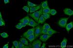 FRS2 Antibody in Immunocytochemistry (ICC/IF)