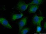 BubR1 Antibody in Immunocytochemistry (ICC/IF)