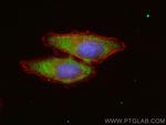 ASCC2 Antibody in Immunocytochemistry (ICC/IF)