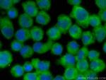 DGKA Antibody in Immunocytochemistry (ICC/IF)