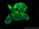 SRP68 Antibody in Immunocytochemistry (ICC/IF)