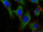 RGS5 Antibody in Immunocytochemistry (ICC/IF)