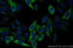 RRM2 Antibody in Immunocytochemistry (ICC/IF)