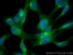 RAB1A Antibody in Immunocytochemistry (ICC/IF)