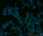 PARK7/DJ-1 Antibody in Immunocytochemistry (ICC/IF)