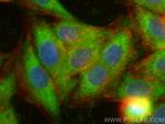 DYNLT3 Antibody in Immunocytochemistry (ICC/IF)