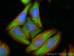 HMGN1 Antibody in Immunocytochemistry (ICC/IF)