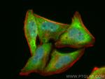 SMN Antibody in Immunocytochemistry (ICC/IF)