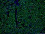 ASGR1 Antibody in Immunohistochemistry (PFA fixed) (IHC (PFA))