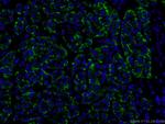 ASGR1 Antibody in Immunohistochemistry (PFA fixed) (IHC (PFA))