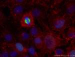 TPX2 Antibody in Immunocytochemistry (ICC/IF)
