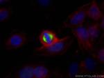TPX2 Antibody in Immunocytochemistry (ICC/IF)