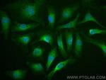 PKIA Antibody in Immunocytochemistry (ICC/IF)