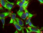 CACYBP Antibody in Immunocytochemistry (ICC/IF)