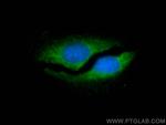 PSMB1 Antibody in Immunocytochemistry (ICC/IF)