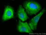 DIO1 Antibody in Immunocytochemistry (ICC/IF)