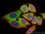 Ficolin-3 Antibody in Immunocytochemistry (ICC/IF)