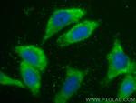 SCEL Antibody in Immunocytochemistry (ICC/IF)