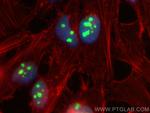 EMG1 Antibody in Immunocytochemistry (ICC/IF)