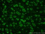 Galc Antibody in Immunohistochemistry (Paraffin) (IHC (P))