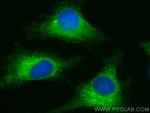 PRKCSH Antibody in Immunocytochemistry (ICC/IF)