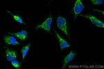 OXCT1 Antibody in Immunocytochemistry (ICC/IF)