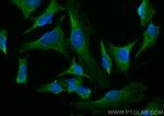 NDP52 Antibody in Immunocytochemistry (ICC/IF)