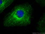NDP52 Antibody in Immunocytochemistry (ICC/IF)
