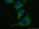PRKACB Antibody in Immunocytochemistry (ICC/IF)