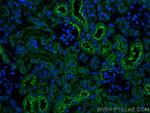 Cystatin C Antibody in Immunohistochemistry (PFA fixed) (IHC (PFA))