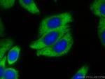 SERPING1/C1 Inactivator Antibody in Immunocytochemistry (ICC/IF)