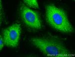 CYP4F11 Antibody in Immunocytochemistry (ICC/IF)