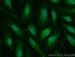 Clusterin Antibody in Immunocytochemistry (ICC/IF)
