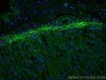 Clusterin Antibody in Immunohistochemistry (PFA fixed) (IHC (PFA))