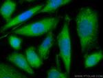 Neurotrophin 4 Antibody in Immunocytochemistry (ICC/IF)