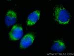ACAA1 Antibody in Immunocytochemistry (ICC/IF)